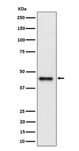 Anti-DAZAP1 Rabbit Monoclonal Antibody Boster Bio