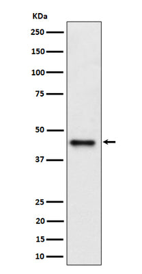 Anti-DAZAP1 Rabbit Monoclonal Antibody Boster Bio