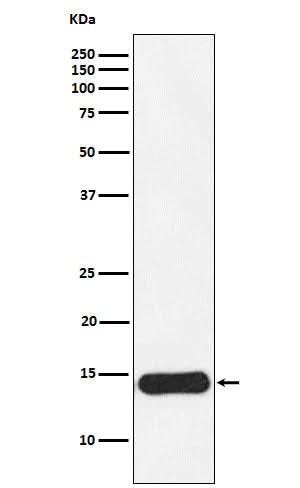 Anti-CRABP1 Rabbit Monoclonal Antibody Boster Bio