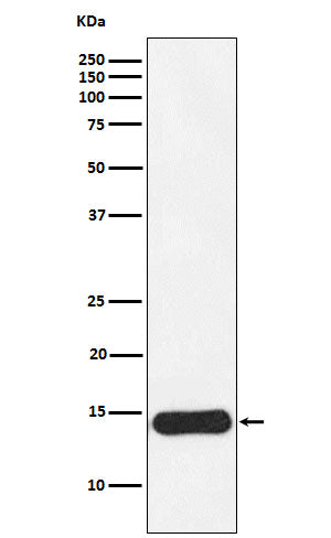 Anti-CRABP1 Rabbit Monoclonal Antibody Boster Bio
