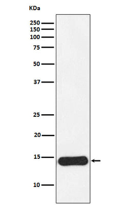 Anti-CRABP1 Rabbit Monoclonal Antibody Boster Bio