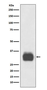 Anti-Mast Cell Tryptase Rabbit Monoclonal Antibody Boster Bio