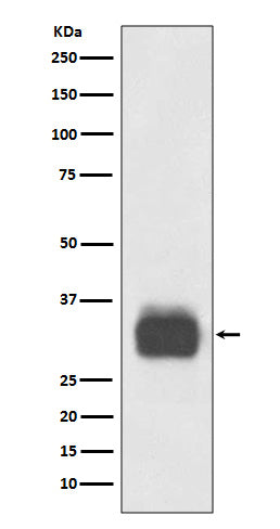 Anti-Mast Cell Tryptase Rabbit Monoclonal Antibody Boster Bio