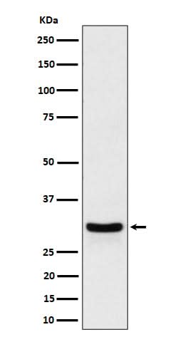 Anti-FRAT1 Rabbit Monoclonal Antibody Boster Bio