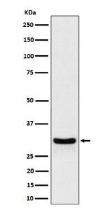 Anti-FRAT1 Rabbit Monoclonal Antibody Boster Bio