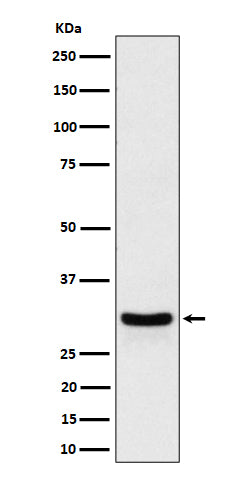 Anti-FRAT1 Rabbit Monoclonal Antibody Boster Bio