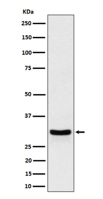 Anti-FRAT1 Rabbit Monoclonal Antibody Boster Bio