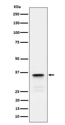 Anti-Lactate Dehydrogenase C Rabbit Monoclonal Antibody Boster Bio