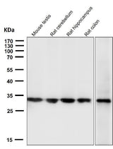 Anti-Calponin CNN1 Rabbit Monoclonal Antibody Boster Bio