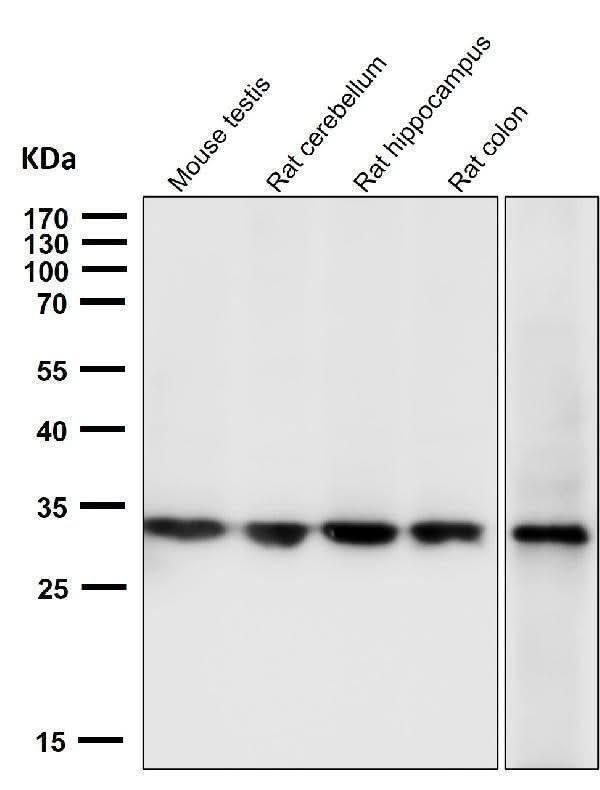Anti-Calponin CNN1 Rabbit Monoclonal Antibody Boster Bio