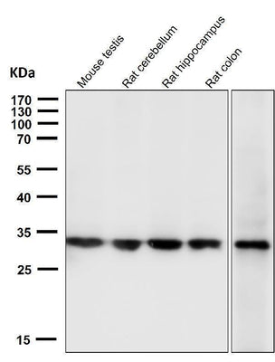 Anti-Calponin CNN1 Rabbit Monoclonal Antibody Boster Bio