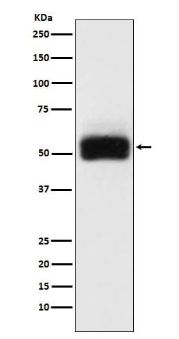 Anti-MMP17 Rabbit Monoclonal Antibody Boster Bio