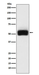 Anti-MMP17 Rabbit Monoclonal Antibody Boster Bio
