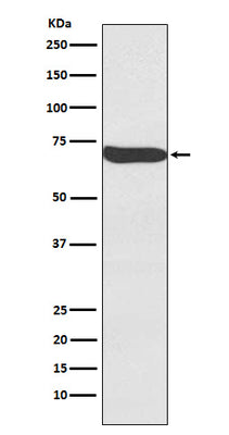 Anti-Frizzled 9 / CD349 Rabbit Monoclonal Antibody Boster Bio