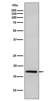 Anti-DNAJC15 Rabbit Monoclonal Antibody Boster Bio