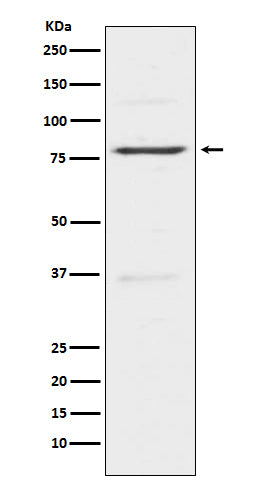 Anti-Insulin Receptor R INSRR Monoclonal Antibody Boster Bio