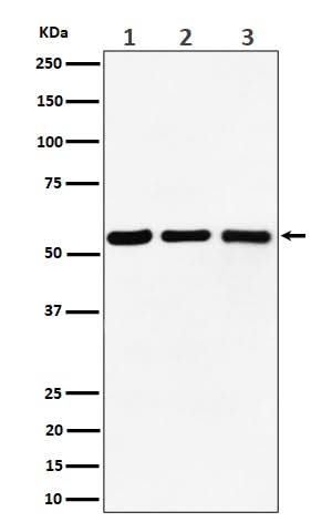 Anti-PRPF4 Rabbit Monoclonal Antibody Boster Bio