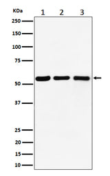 Anti-PRPF4 Rabbit Monoclonal Antibody Boster Bio