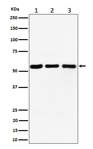 Anti-PRPF4 Rabbit Monoclonal Antibody Boster Bio