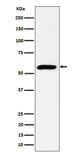 Anti-PRPF4 Rabbit Monoclonal Antibody Boster Bio