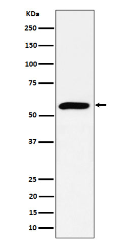 Anti-PRPF4 Rabbit Monoclonal Antibody Boster Bio