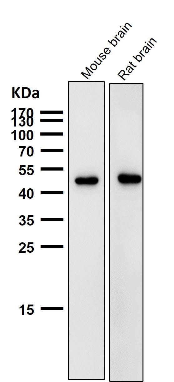 Anti-AZI2 Rabbit Monoclonal Antibody Boster Bio