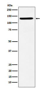 Anti-SF3B3 Rabbit Monoclonal Antibody Boster Bio