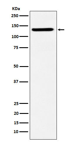 Anti-SF3B3 Rabbit Monoclonal Antibody Boster Bio