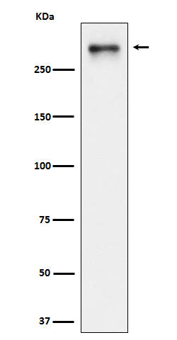 Anti-USP24 Rabbit Monoclonal Antibody Boster Bio