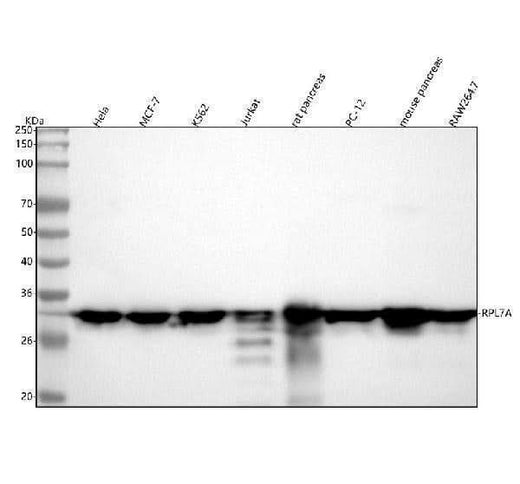 Anti-RPL7A Rabbit Monoclonal Antibody Boster Bio
