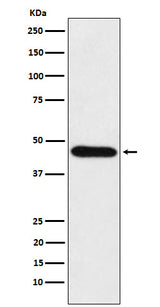 Anti-CDC123 Rabbit Monoclonal Antibody Boster Bio