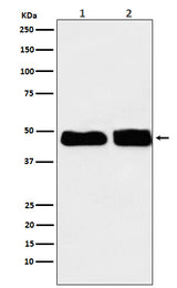 Anti-C4 binding protein Rabbit Monoclonal Antibody Boster Bio