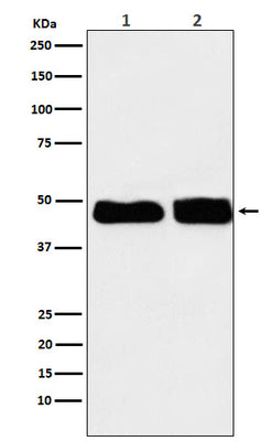 Anti-C4 binding protein Rabbit Monoclonal Antibody Boster Bio