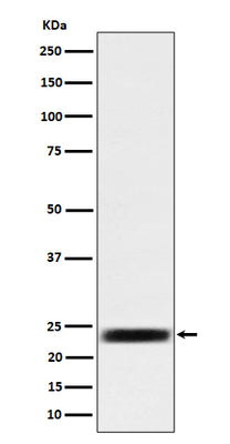 Anti-ARFRP1 / ARP Rabbit Monoclonal Antibody Boster Bio