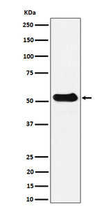 Anti-alpha Tubulin (acetyl K40) Rabbit Monoclonal Antibody Boster Bio