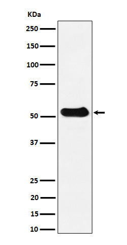 Anti-alpha Tubulin (acetyl K40) Rabbit Monoclonal Antibody Boster Bio