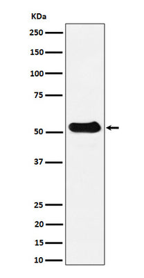 Anti-alpha Tubulin (acetyl K40) Rabbit Monoclonal Antibody Boster Bio