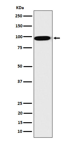 Anti-CLPTM1 Rabbit Monoclonal Antibody Boster Bio