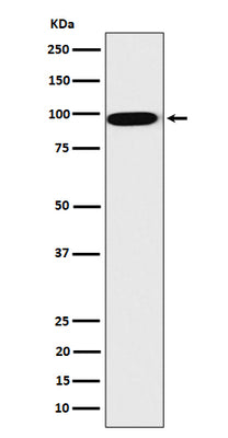Anti-CLPTM1 Rabbit Monoclonal Antibody Boster Bio