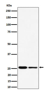 Anti-PMF1 Rabbit Monoclonal Antibody Boster Bio
