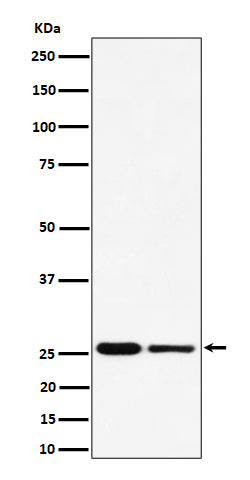 Anti-PMF1 Rabbit Monoclonal Antibody Boster Bio
