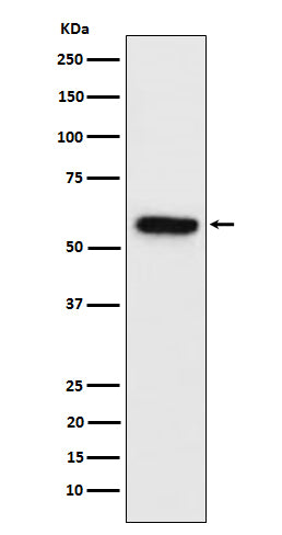 Anti-Synapsin II Rabbit Monoclonal Antibody Boster Bio