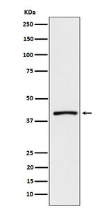 Anti-ATP1B3 Rabbit Monoclonal Antibody Boster Bio
