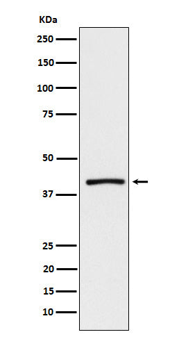 Anti-ATP1B3 Rabbit Monoclonal Antibody Boster Bio