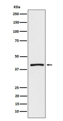 Anti-ATP1B3 Rabbit Monoclonal Antibody Boster Bio