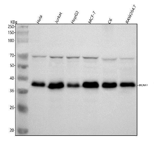 Anti-DCAF7 Rabbit Monoclonal Antibody Boster Bio