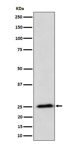 Anti-RPL10A Rabbit Monoclonal Antibody Boster Bio