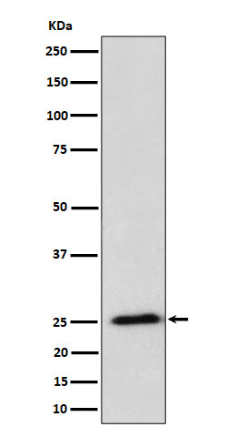 Anti-RPL10A Rabbit Monoclonal Antibody Boster Bio