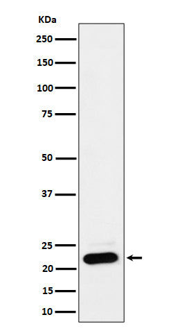 Anti-NDUFB9 Rabbit Monoclonal Antibody Boster Bio