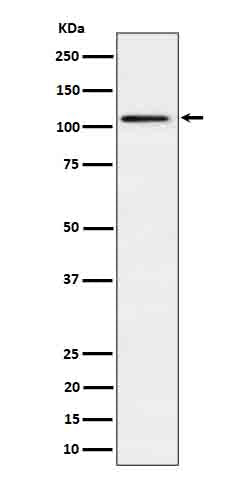 Anti-Ube1L / UBA7 Rabbit Monoclonal Antibody Boster Bio